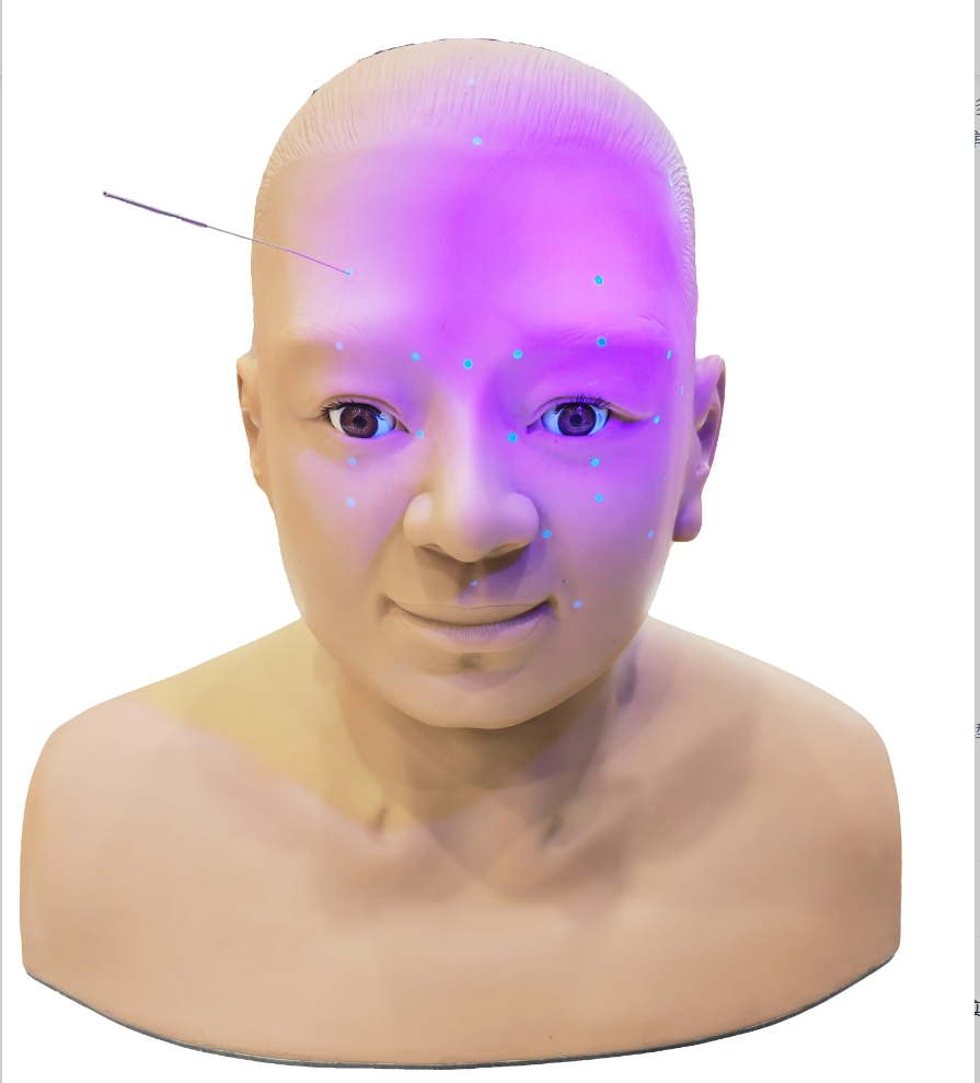 头部针灸1.png